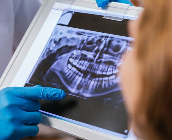 Estudio Dientes y Encías