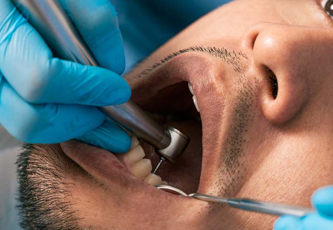 Diagnosticar enfermedad periodontal