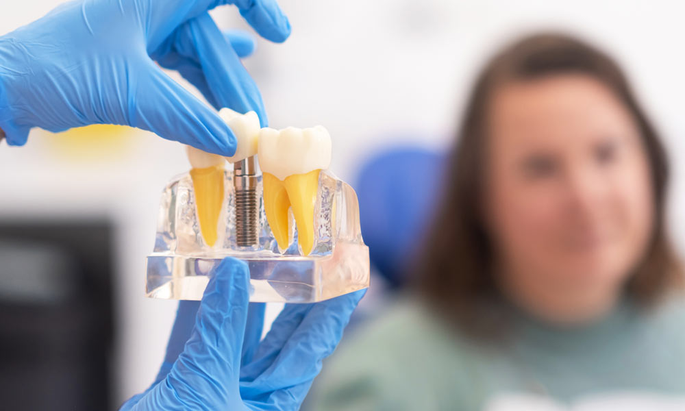 El implante dental es un arma de doble filo