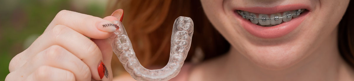 Ventajas Ortodoncia Invisible